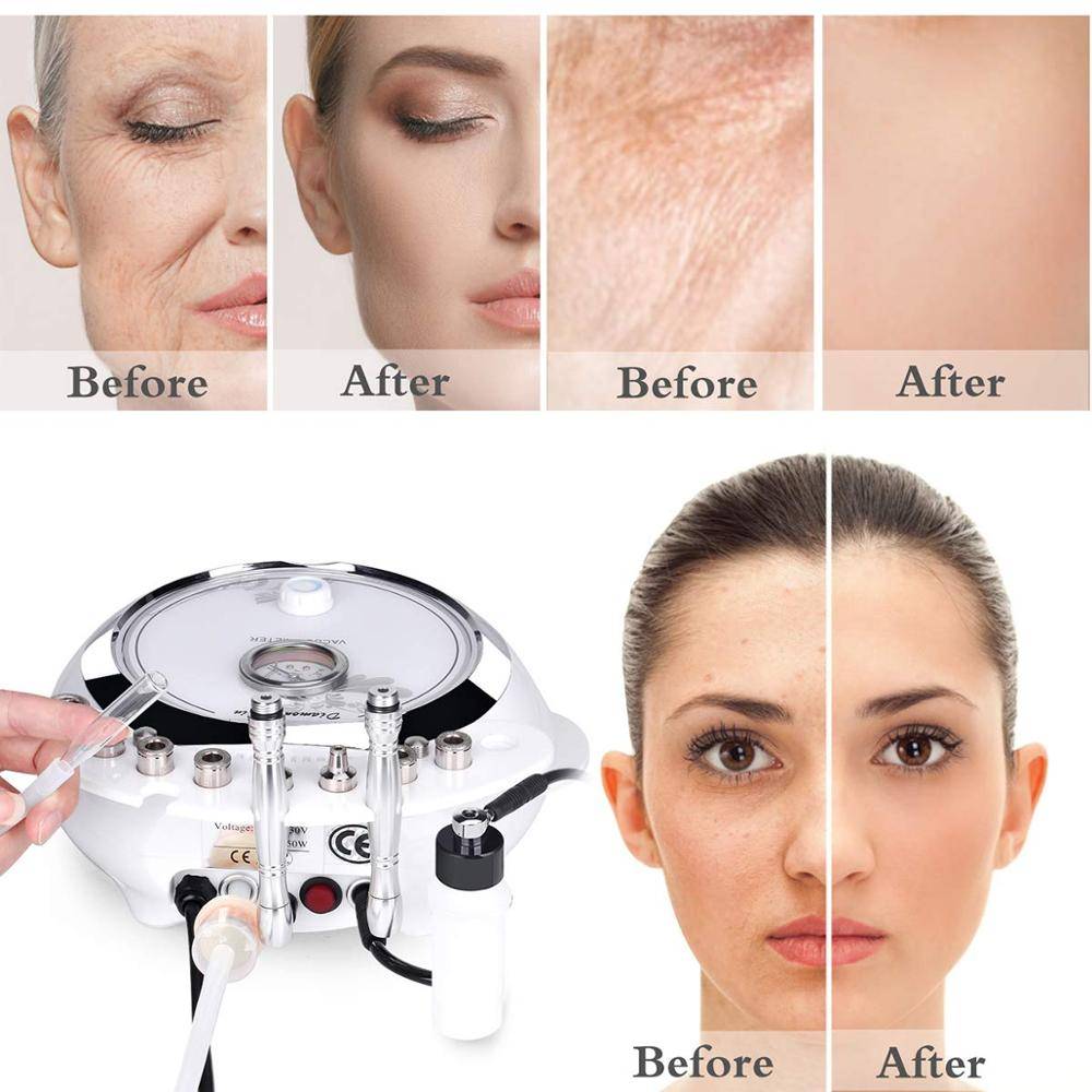 Professional Diamond Microdermabrasion Machine For Home Using ...