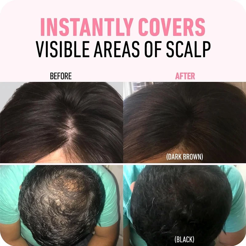 Hair Line Powder 4g Black Root Cover Up Natural Instant Waterproof Hairline Shadow Powder Hair Concealer Coverage 14 Color Hair Line Powder 4g Black Root Cover Up Natural Instant Waterproof Hairline Shadow Powder Hair Concealer Coverage 14 Color